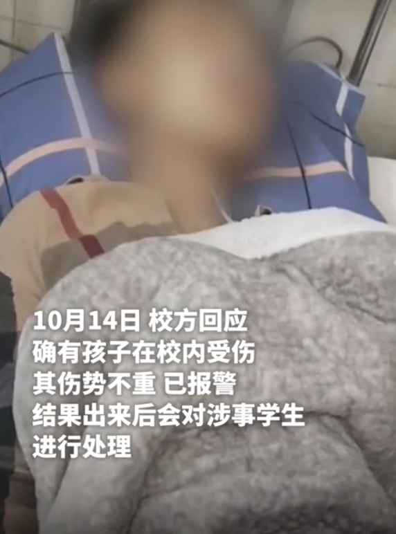 初三学生在校被人用刀刺伤 校园安全引热议