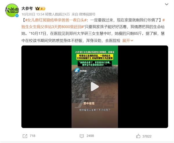 女儿患红斑狼疮单亲爸爸一夜白头：得了红斑狼疮有救吗